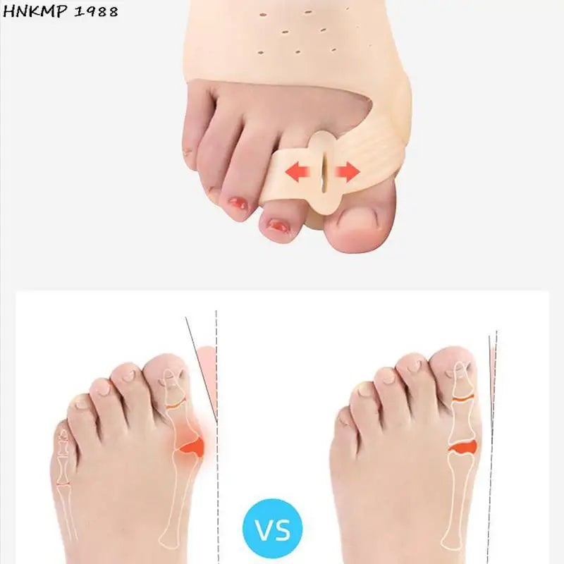 Silicone Toe Separador para Bunion, Bunion Corrector, Bunion Valgus, Dedo Haluksy, Hallux